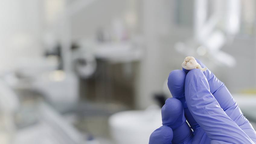 Tooth Extractions Evergreen Family Dentistry P C Evergreen Colorado Tooth Extractions Evergreen Family Dentistry P C Evergreen Colorado