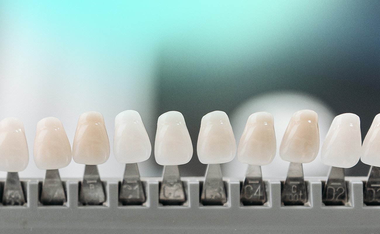 Tooth Veneers Pros And Cons