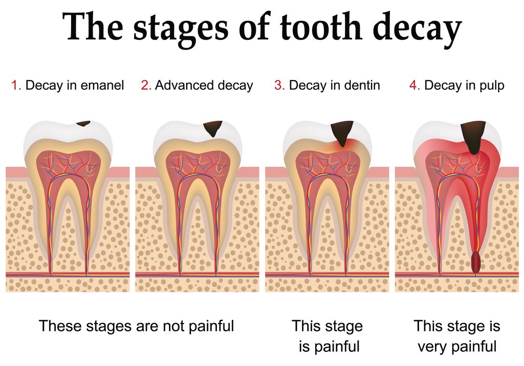 Toothache After Cold