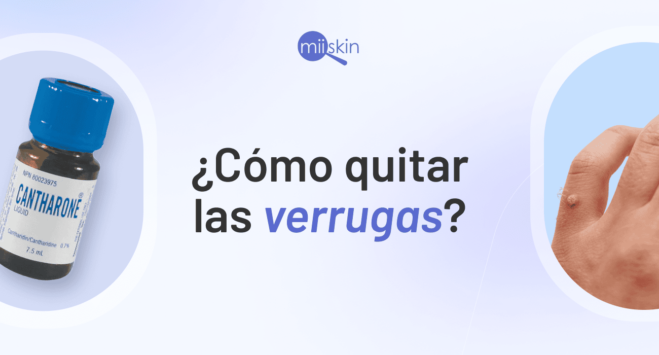 Tratamiento Para Ojo De Pescado Tratamiento Para Ojo De Pescado