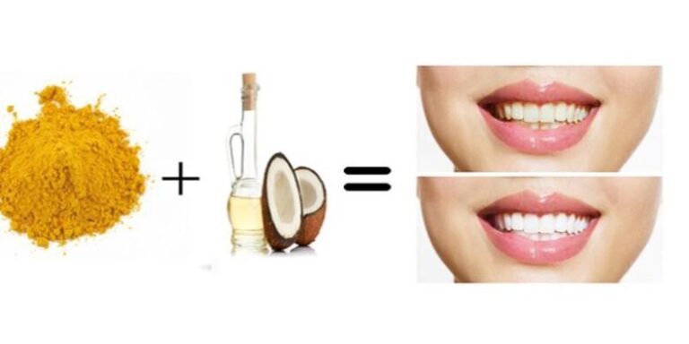 Turmeric Teeth Whitening Facts