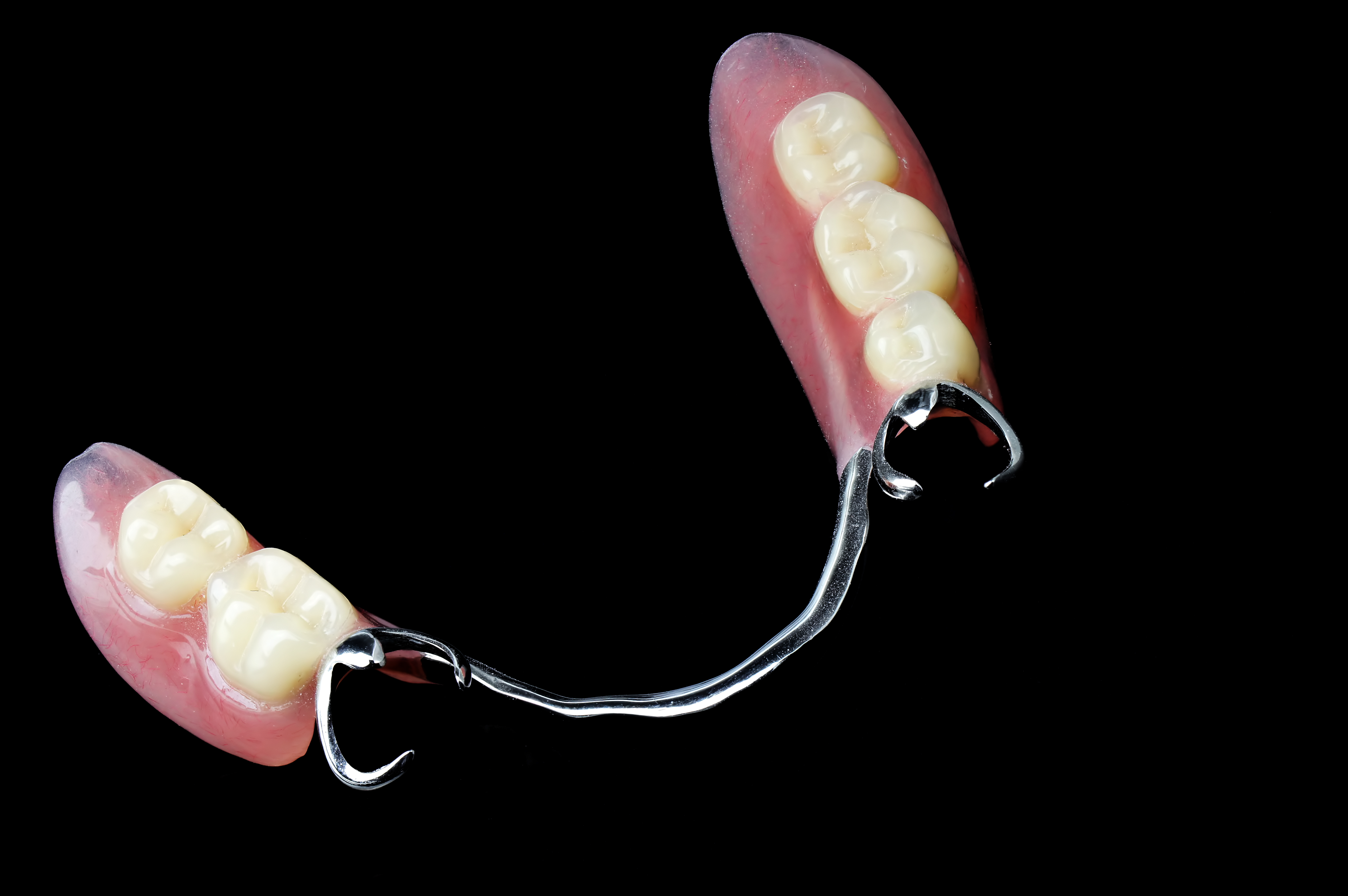 Types Of Partial Dentures