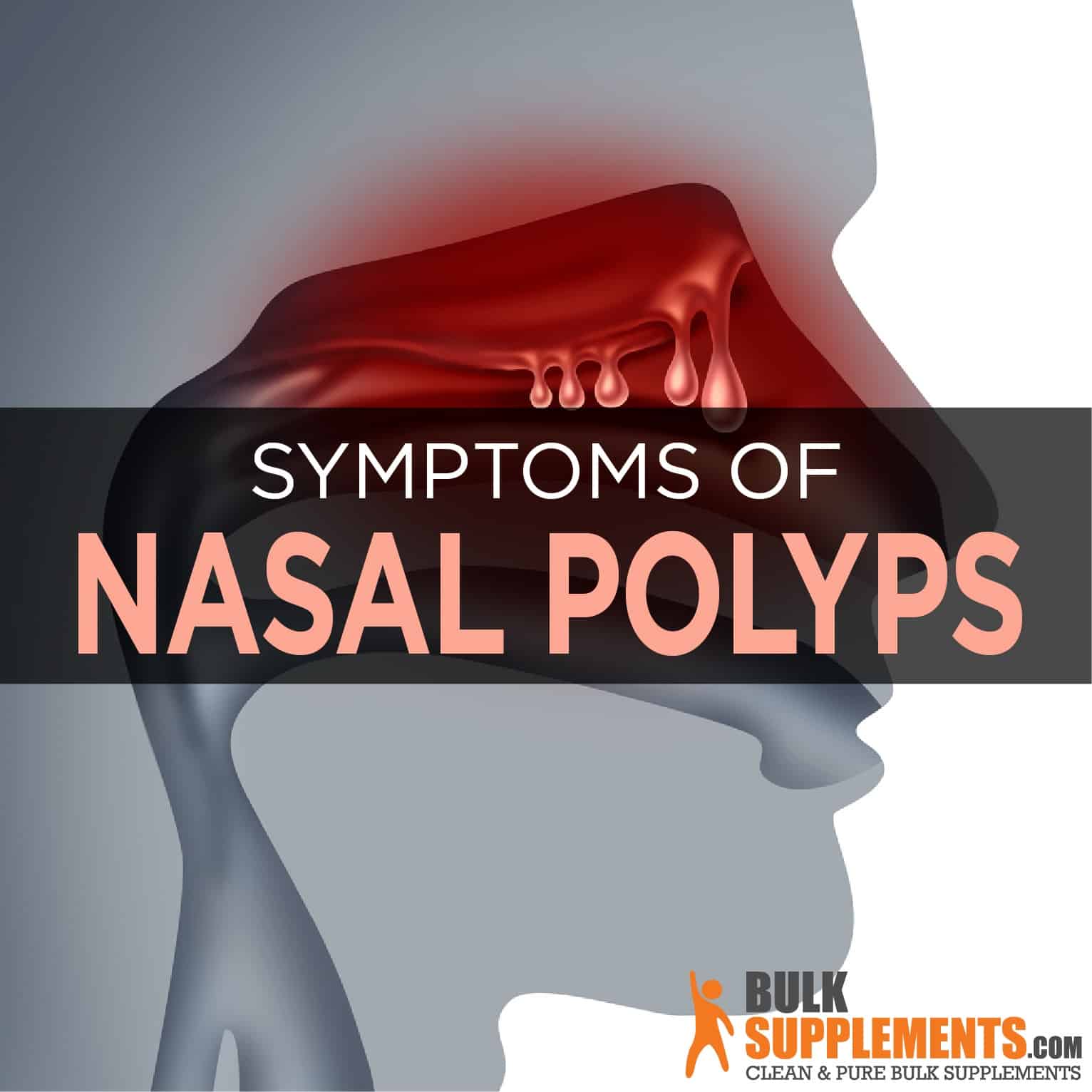What Are Cervix Polyps? Symptoms & Treatment