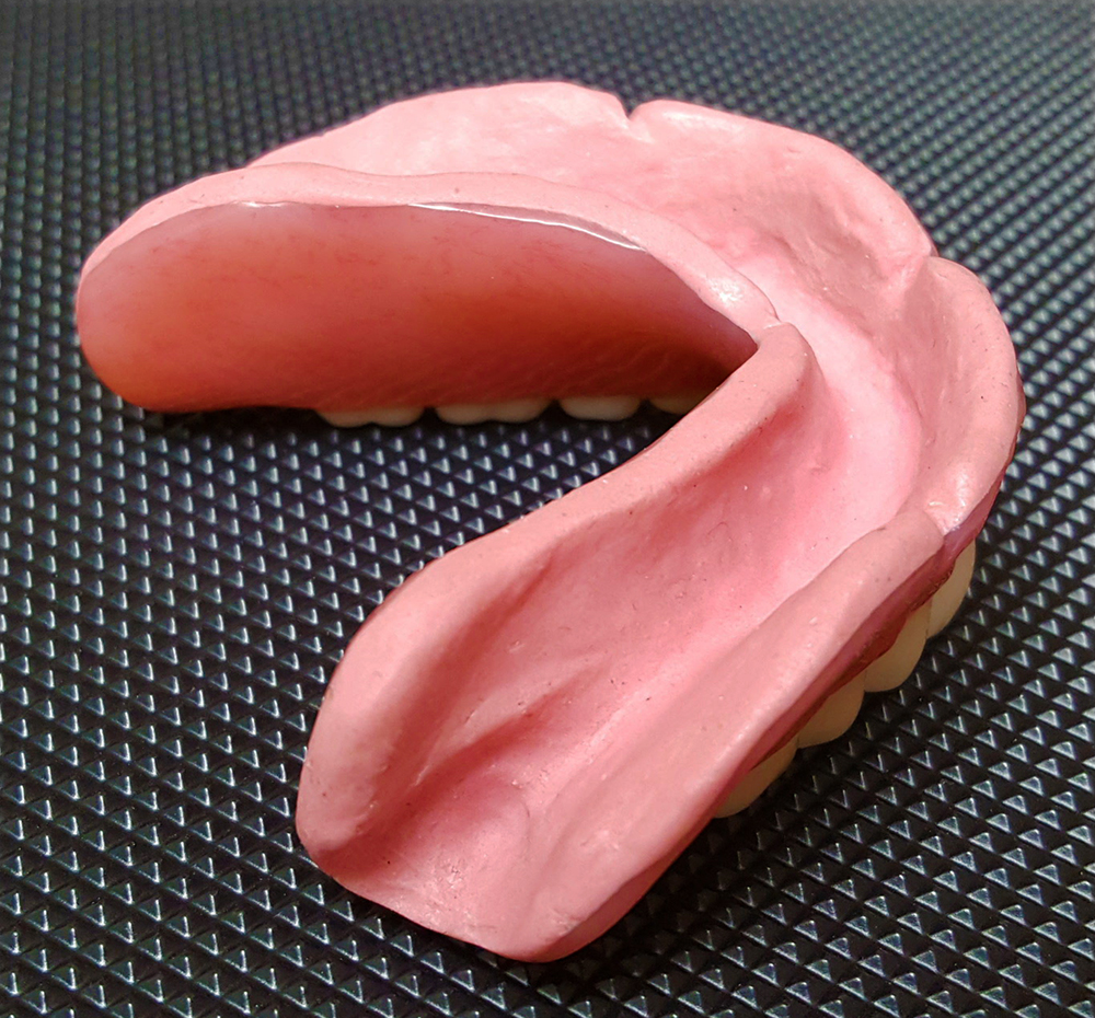 What Are Soft Dentures