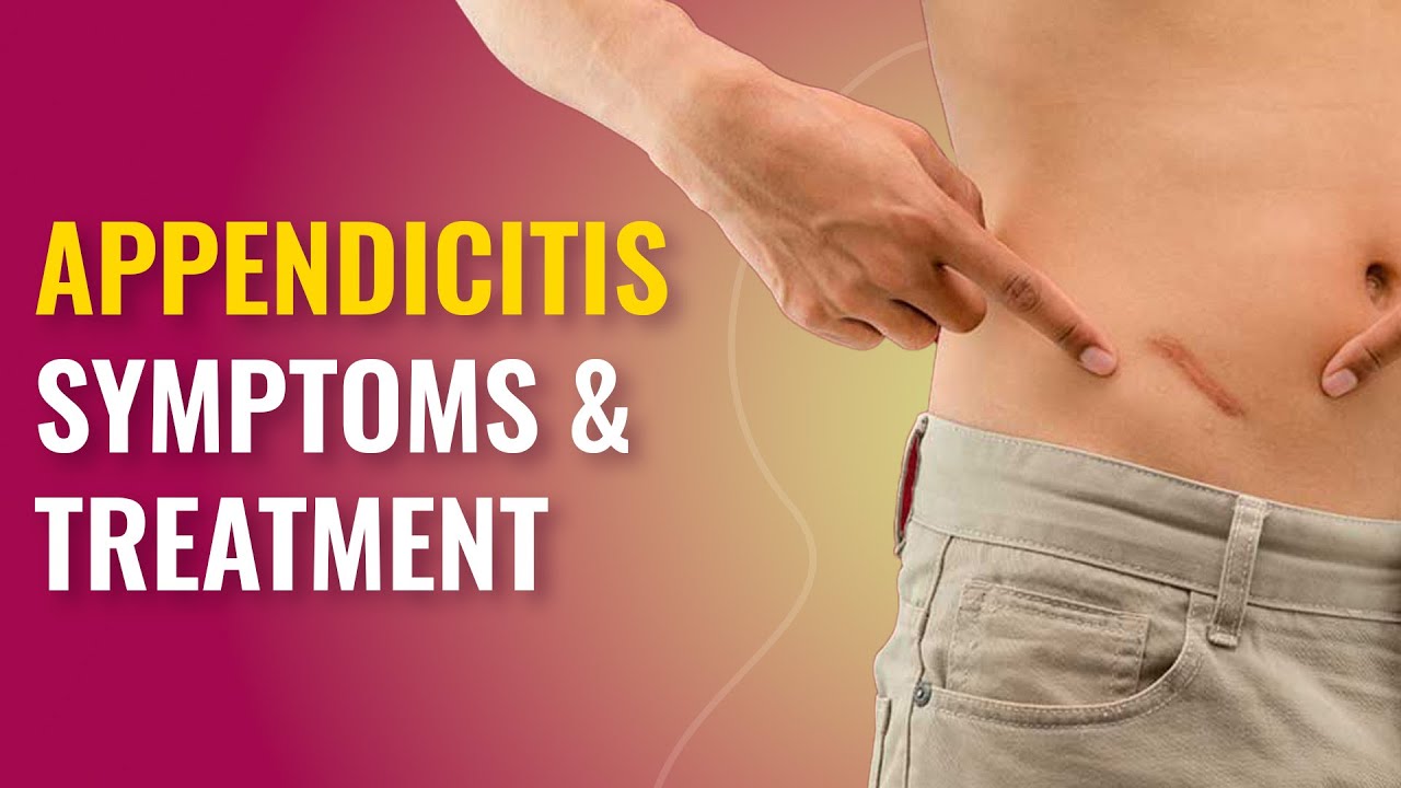 What Causes Appendicitis? Symptoms & Treatment
