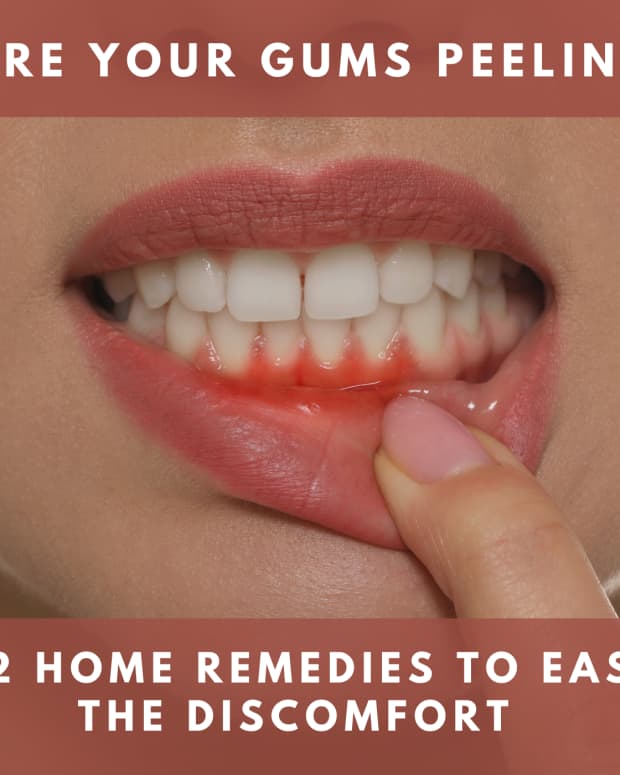 What Causes Cut On Your Gums? Fast Relief Tips