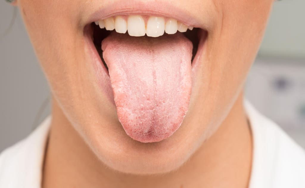 What Causes Dry Mouth From Alcohol? Quick Relief