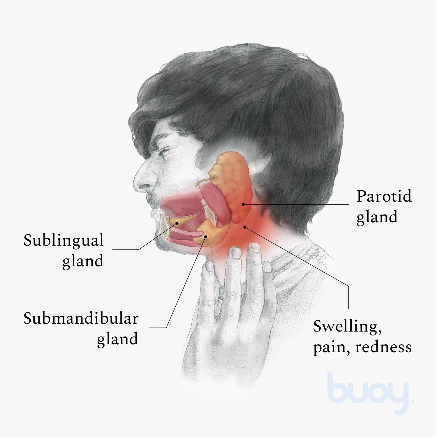 What Causes Salivary Gland Cysts? Expert Treatment