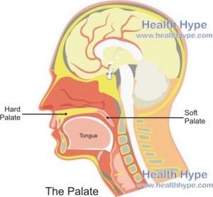 What Causes Sore Palate? Instant Relief Tips