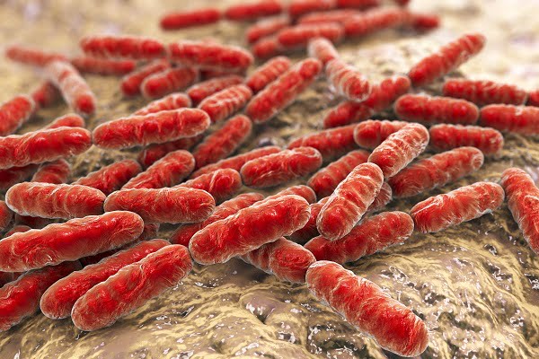 What Causes Strep Bad Breath? Fix Halitosis