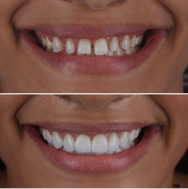 What Is Aspen Dental Oakview? Affordable Care Options