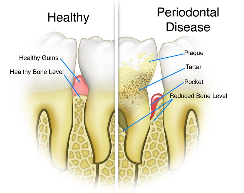 What Is Good Gum For Teeth? Healthy Smiles