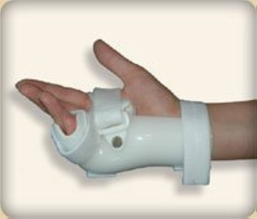 What Is Ulnar Gutter Splint? Boxer Fracture Relief What Is Ulnar Gutter Splint? Boxer Fracture Relief