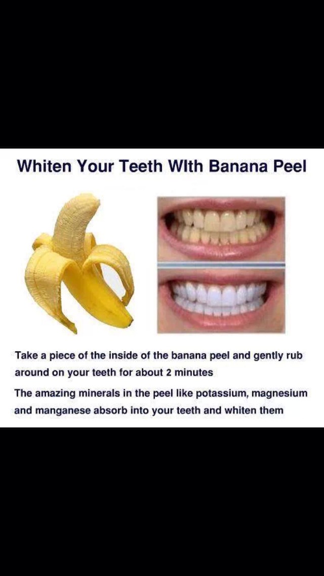What Whitens Teeth Faster Than Banana Peel? Tips Inside