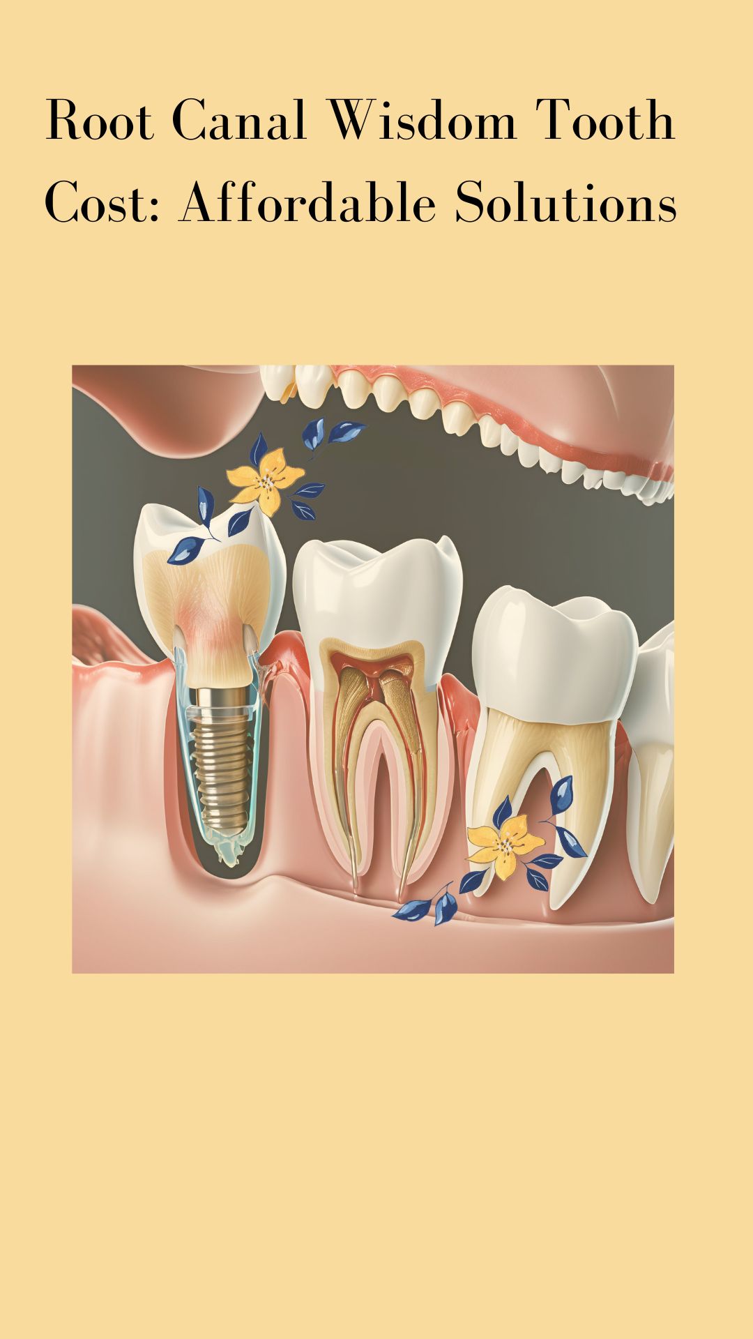 What's Bridge For Tooth Cost? Affordable Solutions What's Bridge For Tooth Cost? Affordable Solutions
