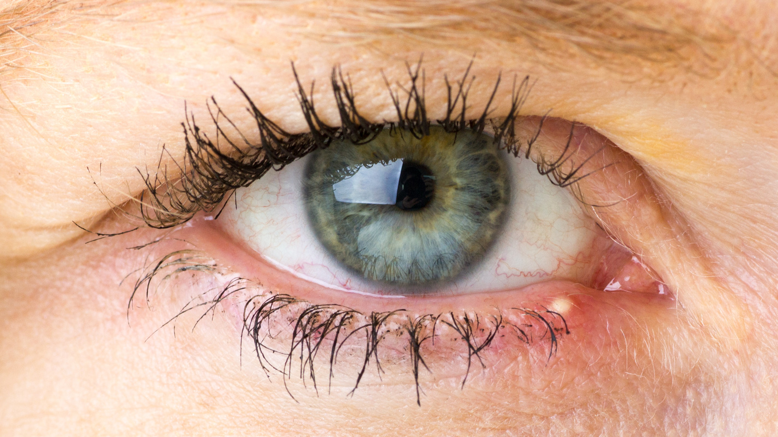 What's Causing Feeling Inside Eye? Find Relief