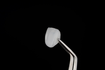 What's Veneers Payment Plan Near Me? Affordable Options