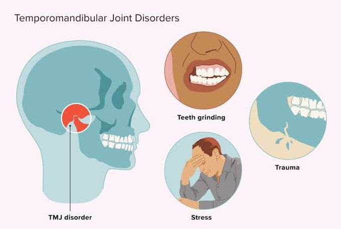 Why Does Tmj Make Me Dizzy? Get Answers