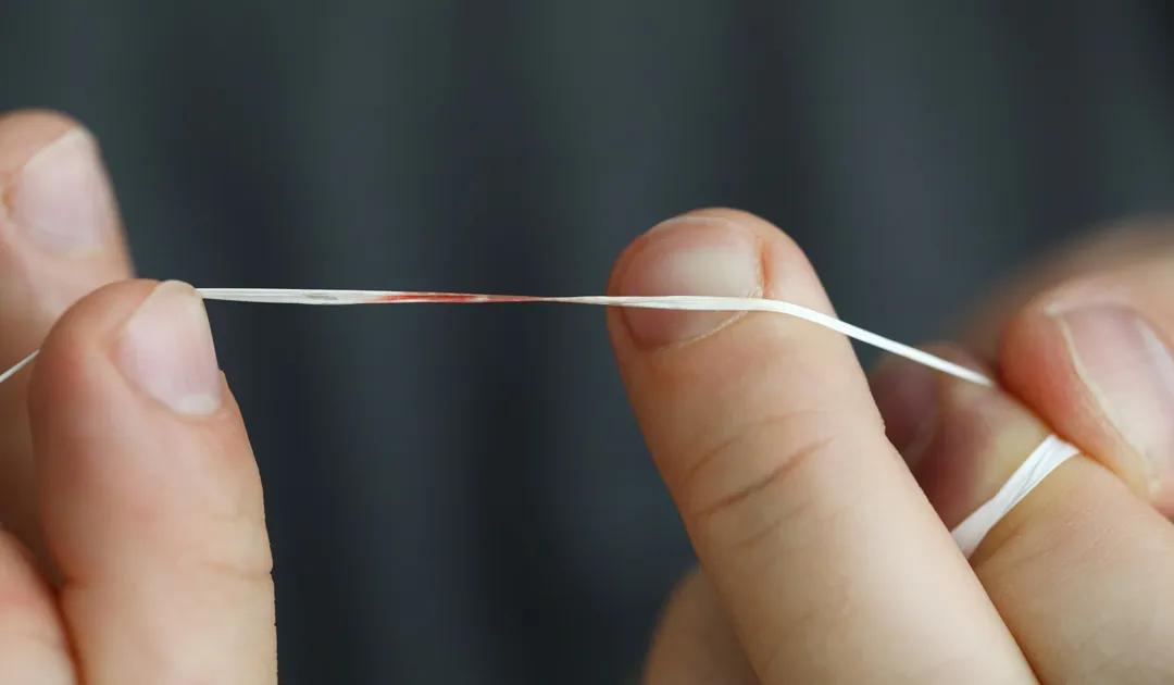 Why Gums Bleed After Flossing? Stop The Bleeding