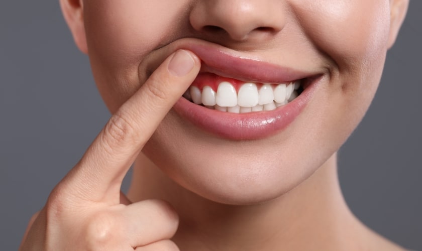 Why Gums Inflamed After Flossing? Relief Tips Why Gums Inflamed After Flossing? Relief Tips
