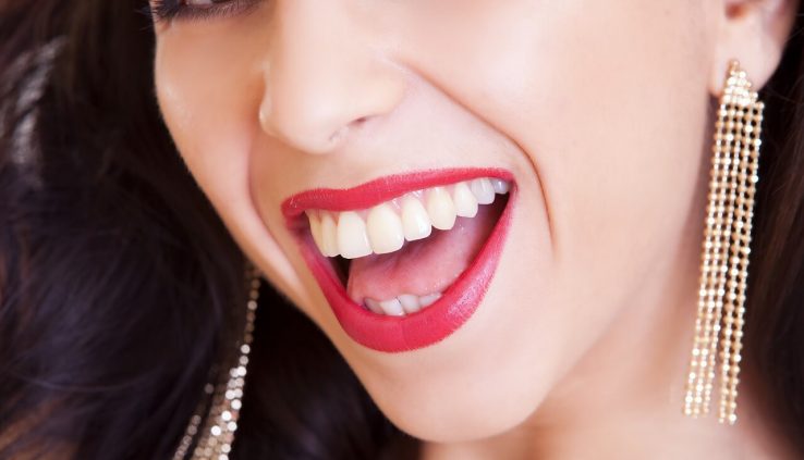 Why Sore After Cavity Filling? Quick Relief Tips
