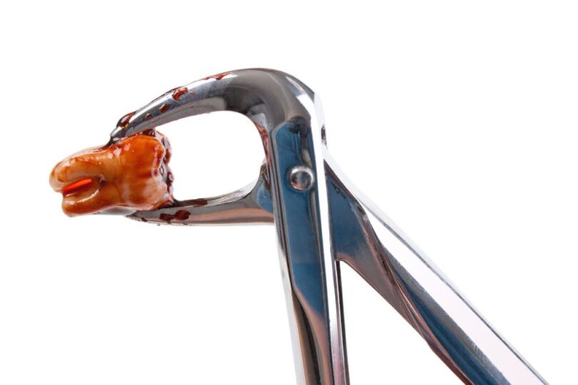 Wisdom Tooth Odor Cure: Fresh Breath Solutions