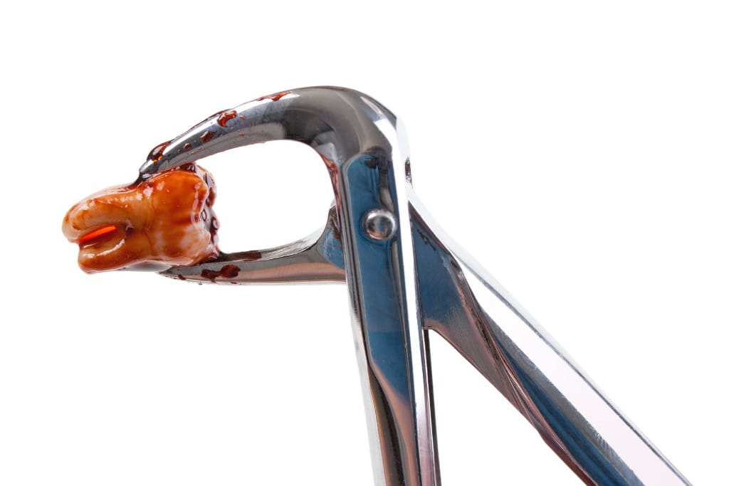 Wisdom Tooth Odor